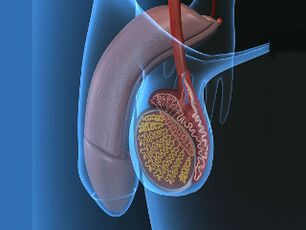 Varicocele and testicular pain on arousal